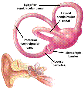 Vertigo Dr Manish Sinha, DM ( Neurology ), Panchkula, Chandigarh vertigo Dr Manish Sinha, DM ( Neurology ), Panchkula, Chandigarh